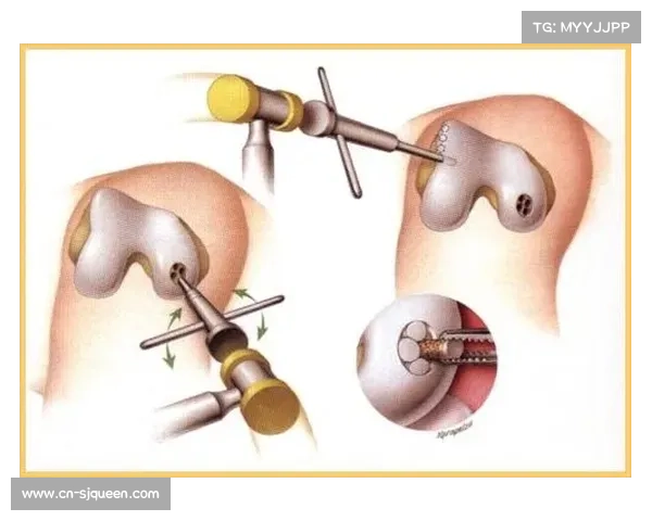 希尔接受软骨移植手术积极康复 计划2026年底重返赛场